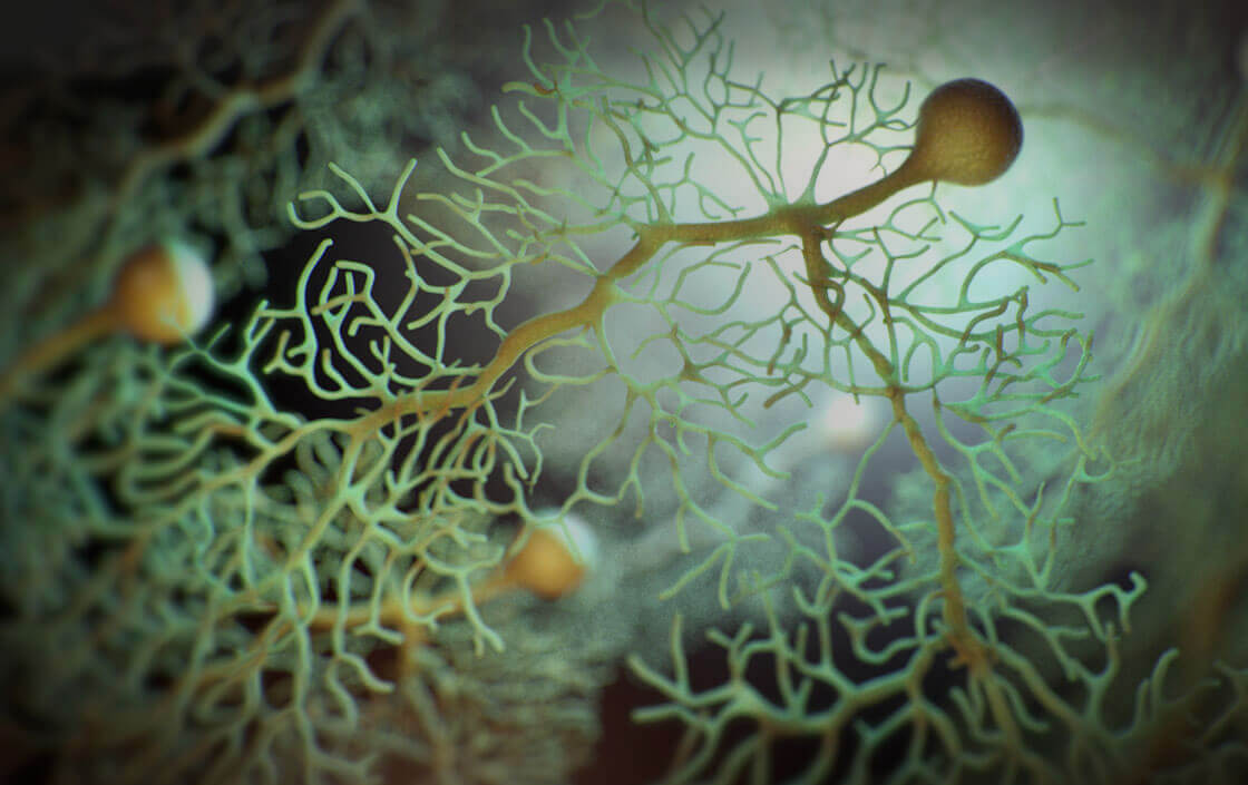 Ionic Screening Panel