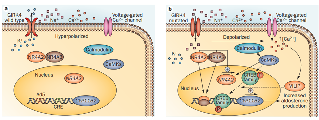Effect of KCNJ5 mutations on adrenal glomerulosa cells.